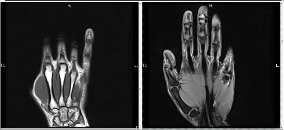 Фото снимок МРТ лучезапястного сустава